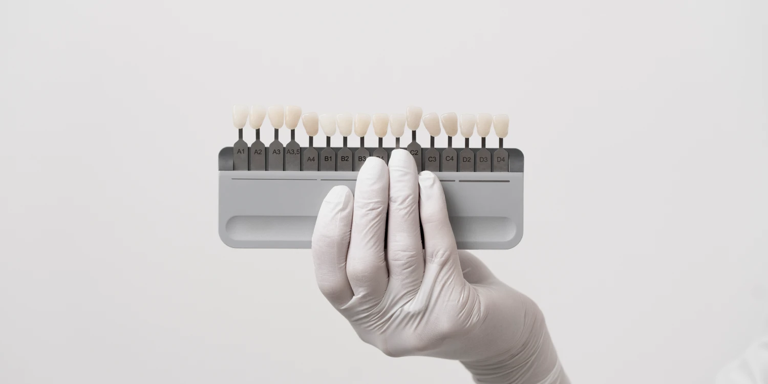 Clinica Windental Tirana - reception e accoglienza pazienti