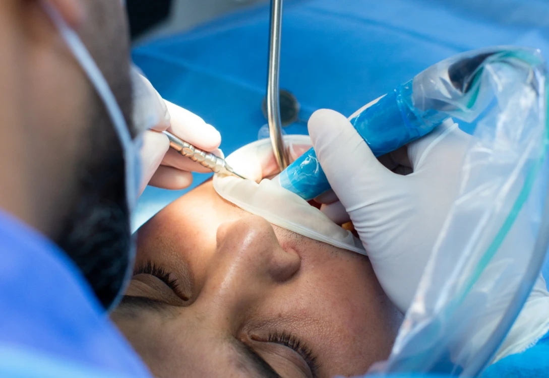 Chirurgia orale Albania - estrazione denti del giudizio Windental