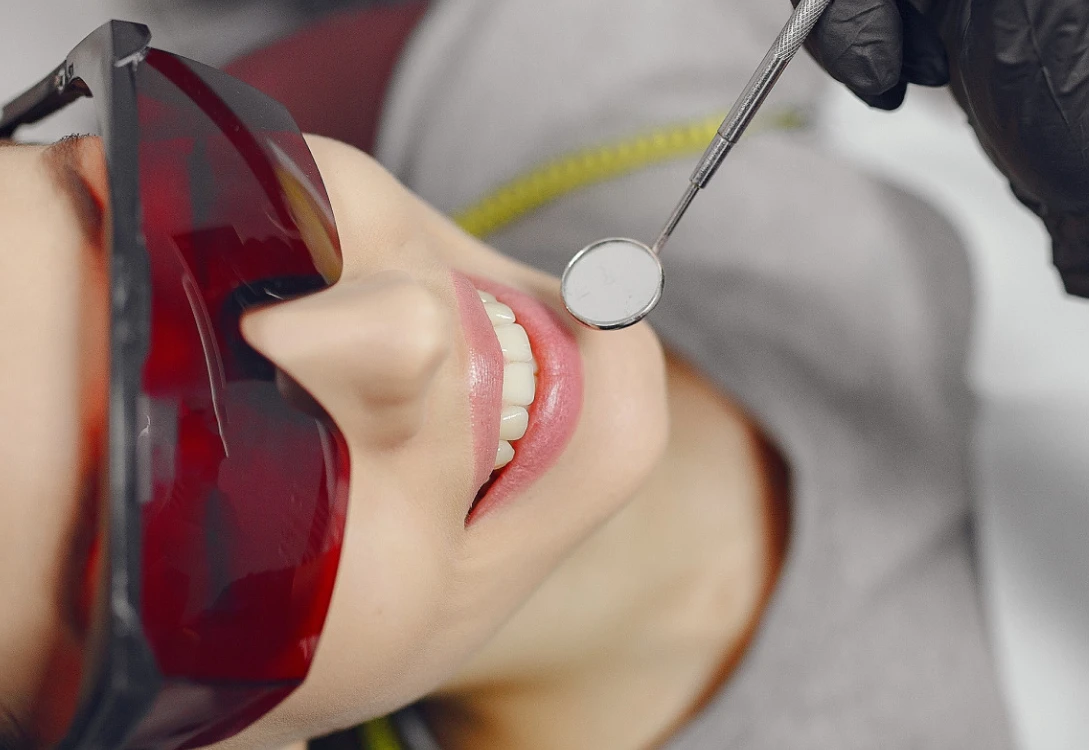 Odontoiatria estetica Albania - sbiancamento e restauro sorriso Windental