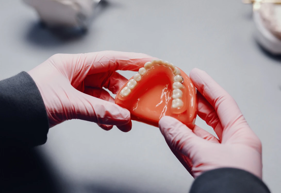 Protesi provvisoria fissa su impianti - Windental cure dentali Albania